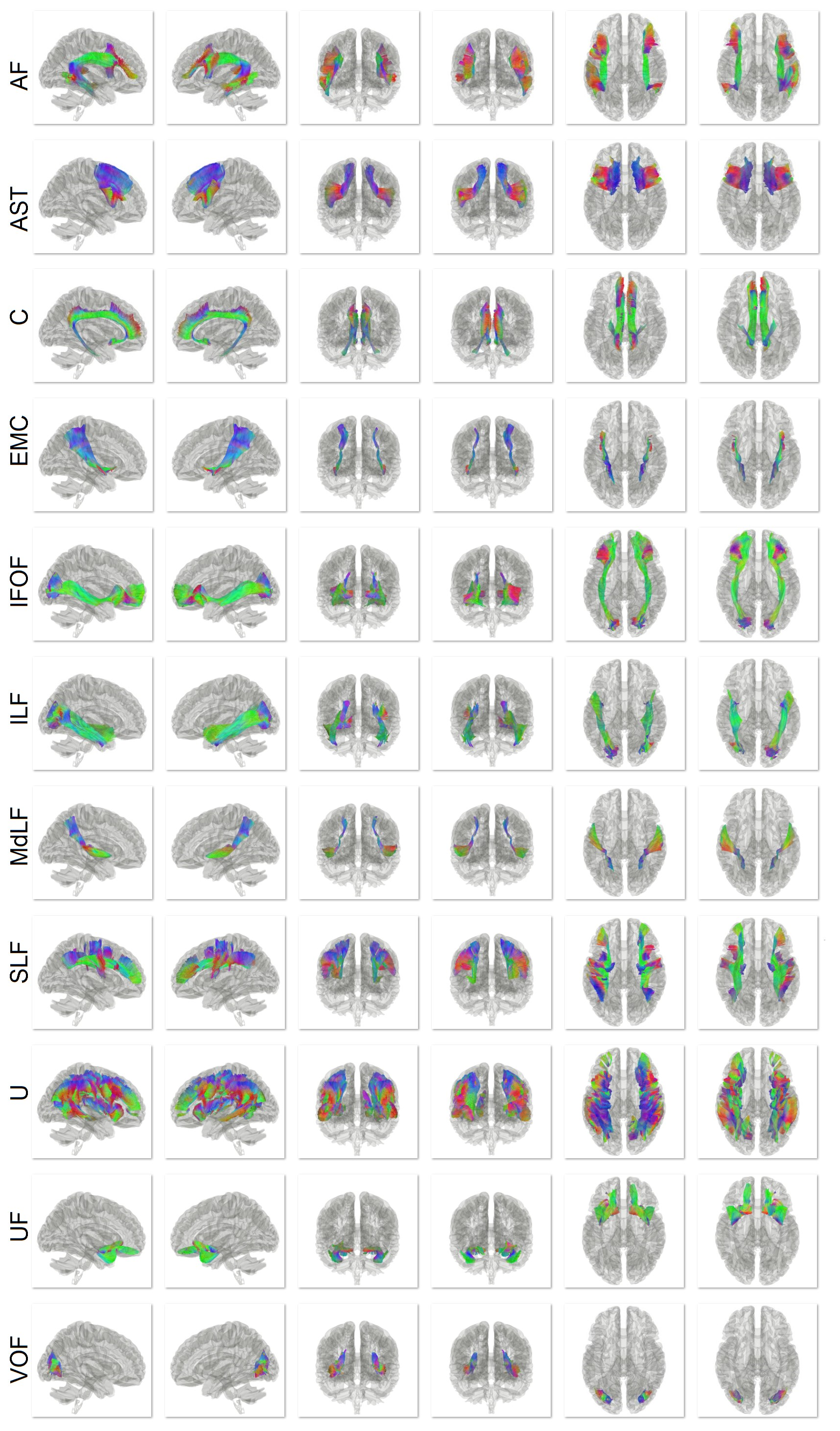 A colourful map of the brain's long association fibre pathways.