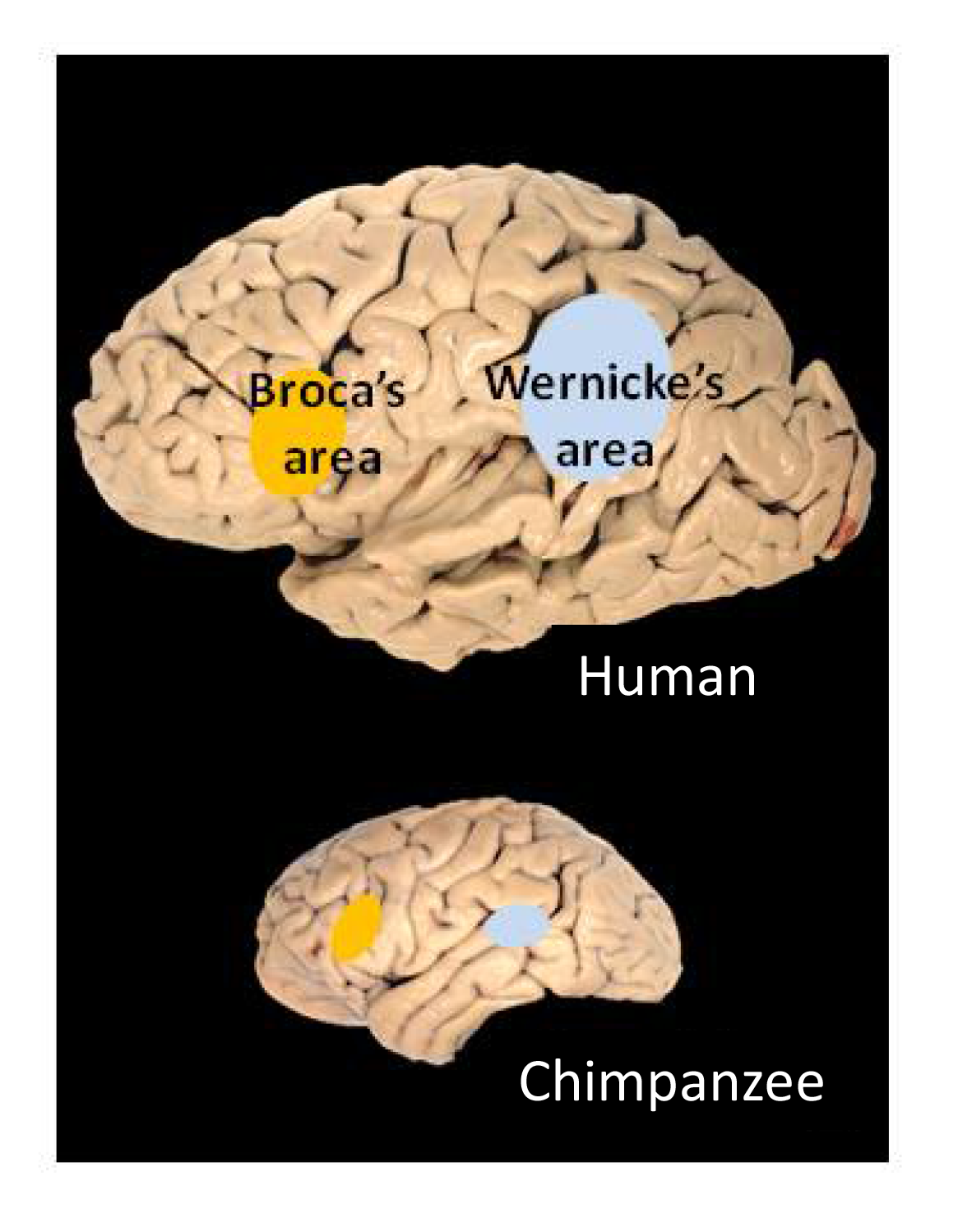 A side view of the left hemisphere with two language regions marked.
